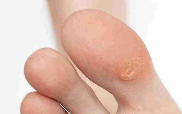 From Kernel to Commodity: The Journey of Corn Processing 1 Understanding Corns Role in the Global Agriculture Landscape